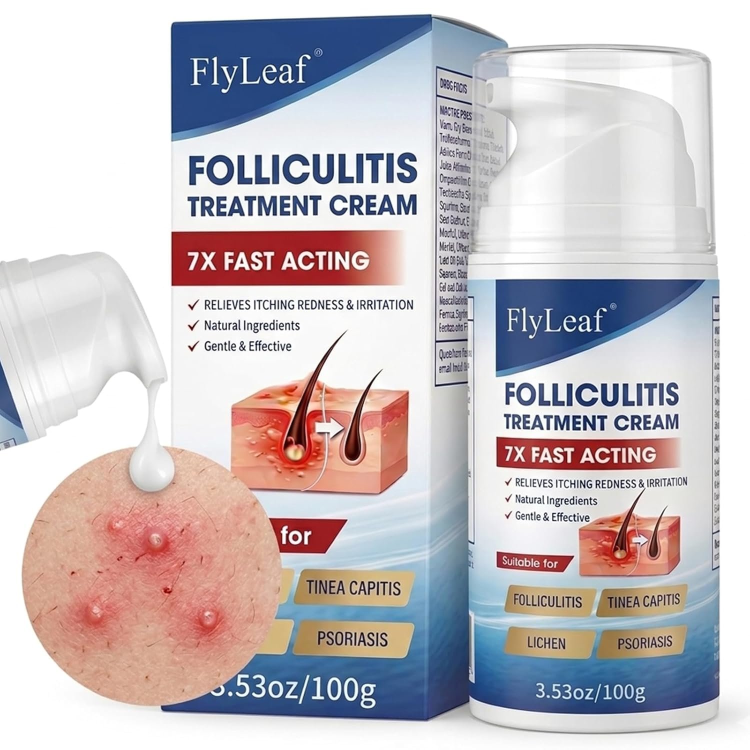 Folliculitis Treatment Cream – 5% Benzoyl Peroxide & Tea Tree Oil for Scalp Bumps, Razor Burn & Body Breakouts – Fast Acting & Effective Itch Relief – 100g/3.53oz
